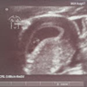 Meet your Posher, Ambia